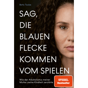 Sag, die blauen Flecke kommen vom Spielen